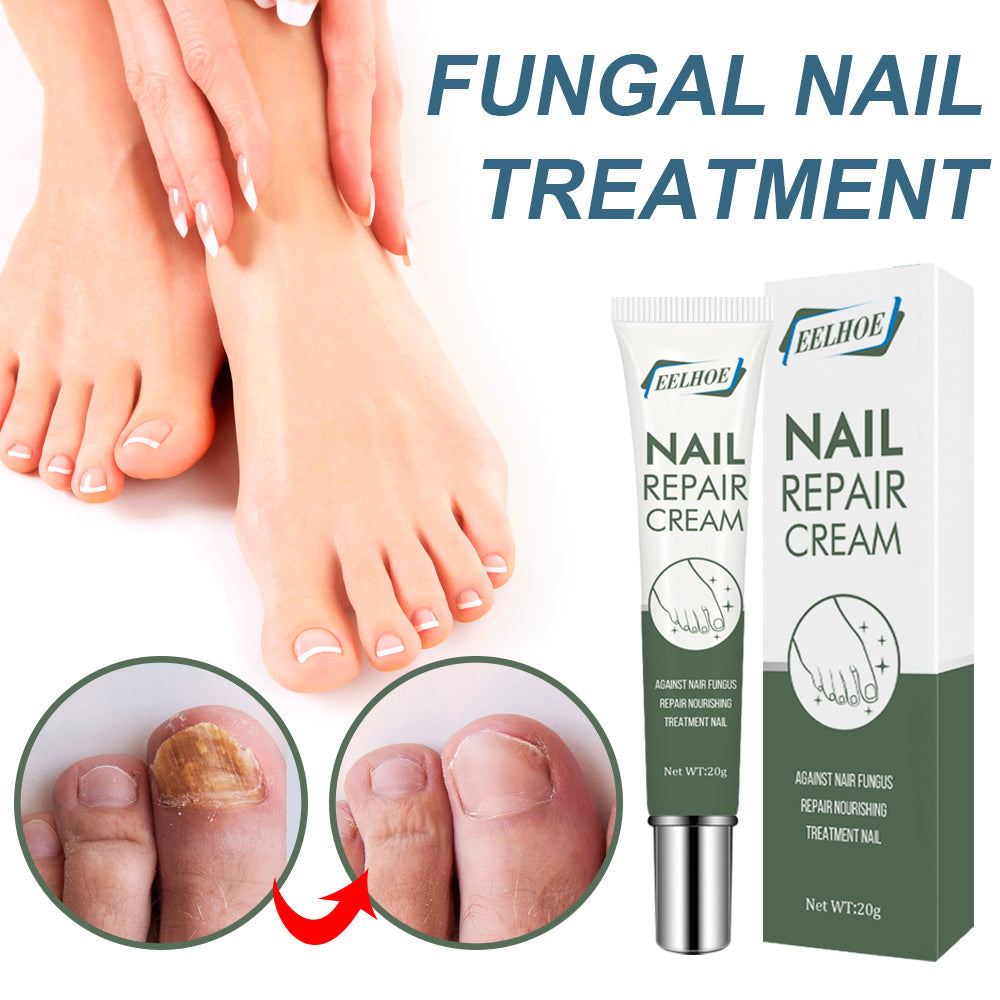 Foot & Nail Repair Cream – Thickening & Restorative
