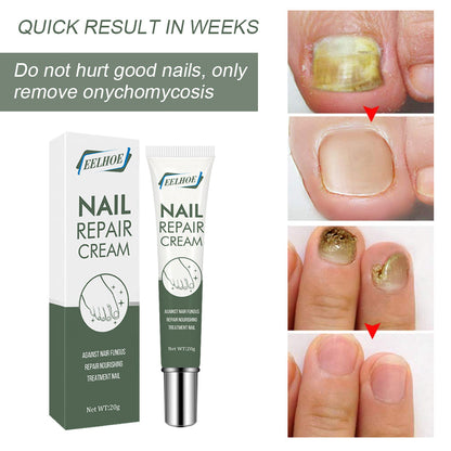 Foot & Nail Repair Cream – Thickening & Restorative