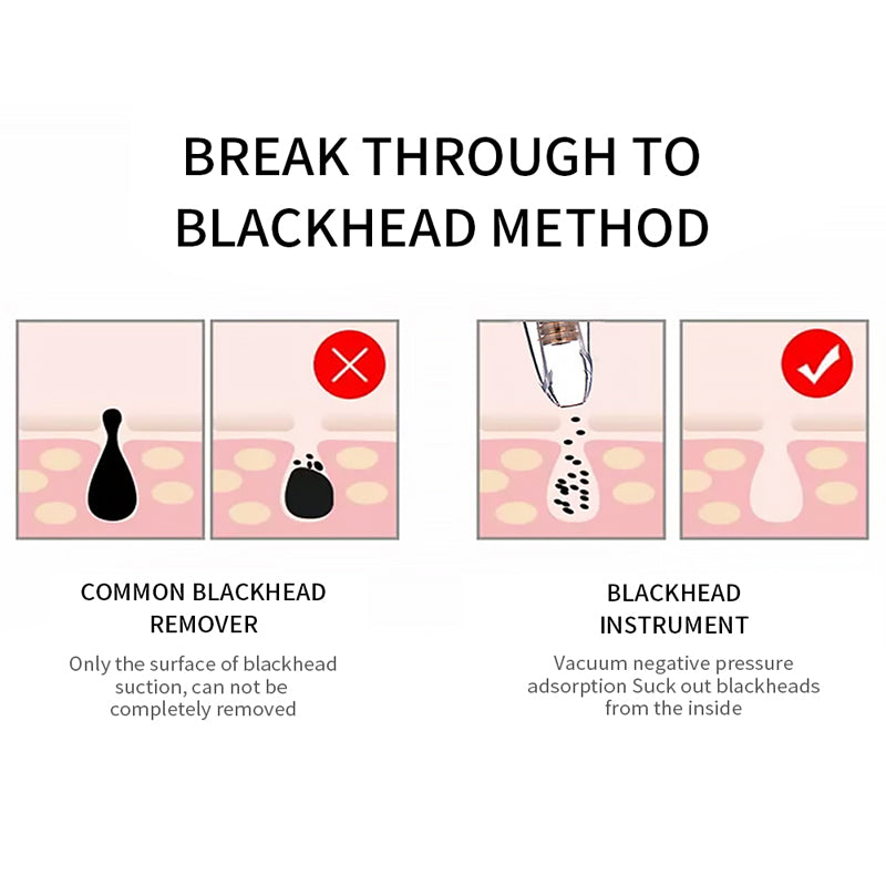 Blackhead Remover Vacuum – Deep Pore Cleaner